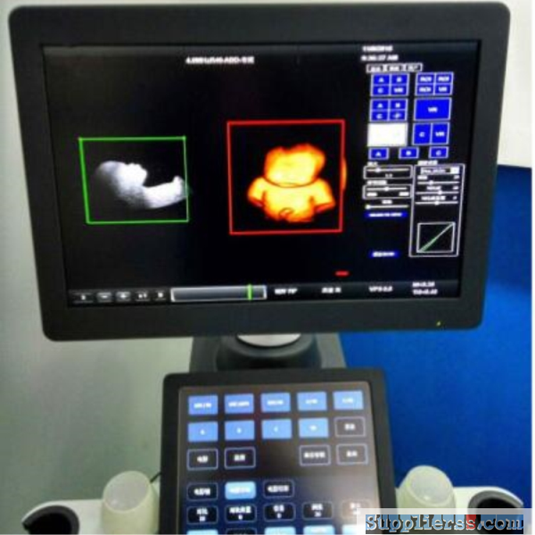 4d-3d-color-doppler-ultrasound/high-end-portable-color-doppler-ultrasound40
